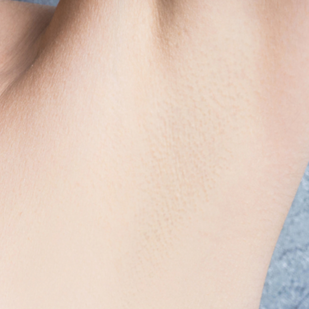 Hair Removal Formula (8).png__PID:46389fe7-ca0b-4157-8ff4-dc783574d882